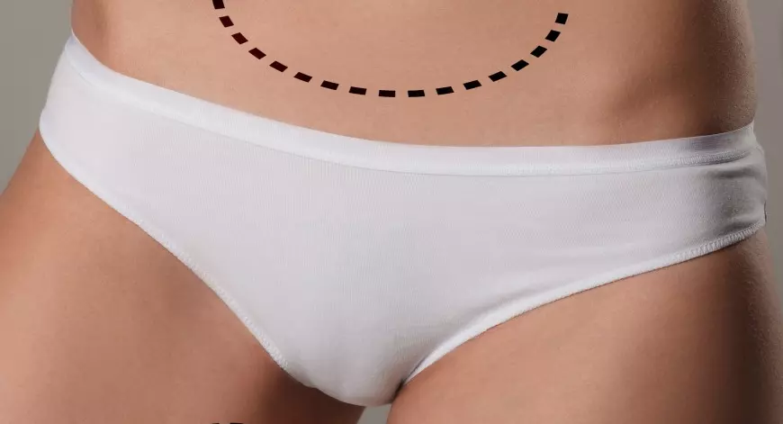 lábios vaginais desproporcionais